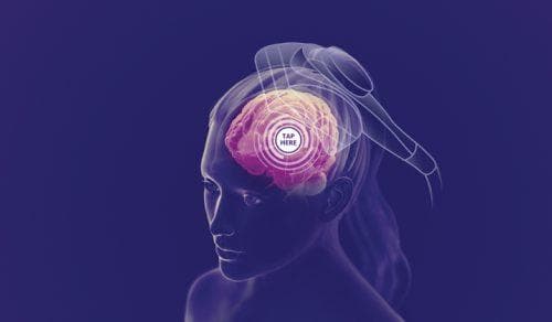 Close-up of the NeuroStar Advanced Therapy system